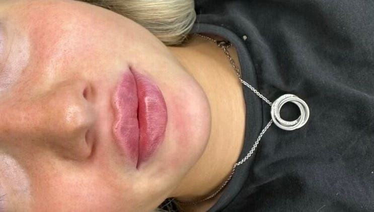 Close-up of enhanced lips at Filtered Faces, Northampton, England, GB.