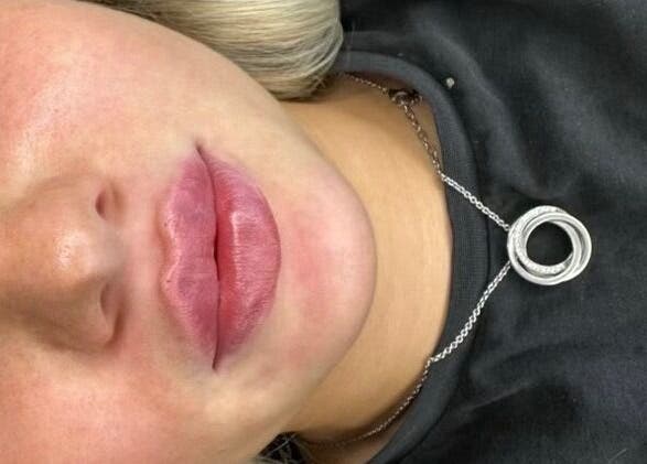 Close-up of enhanced lips at Filtered Faces, Northampton, England, GB.