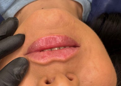 Lip treatment at MG Institute of Beauty & Training Academy in Cheltenham, England, GB.