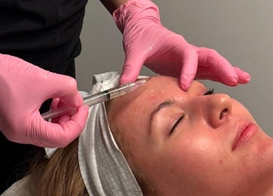 Facial rejuvenation at Skinrise in London, England, GB with pink gloves and a syringe.