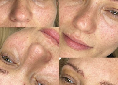Close-up of radiant skin after treatment at Patrycja Swiatczak Laser & Skin in Wonderlust Studio, Warrington, England, GB.