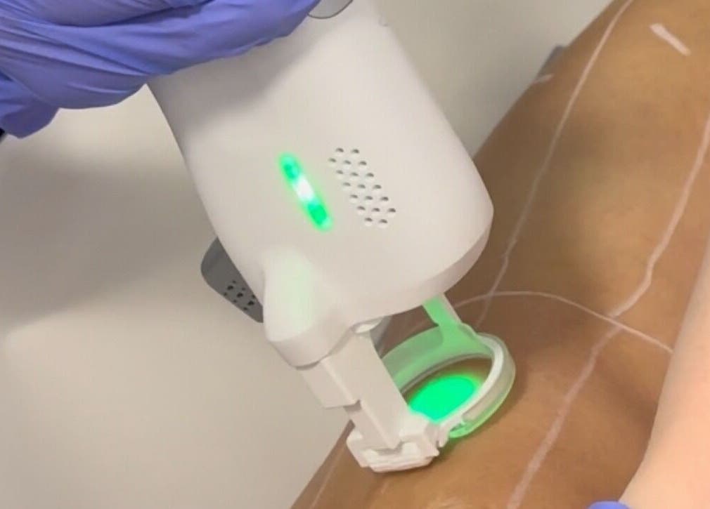 Soin laser esthétique chez Duvera à Montréal, Québec, CA, proposant des traitements avancés pour la peau.