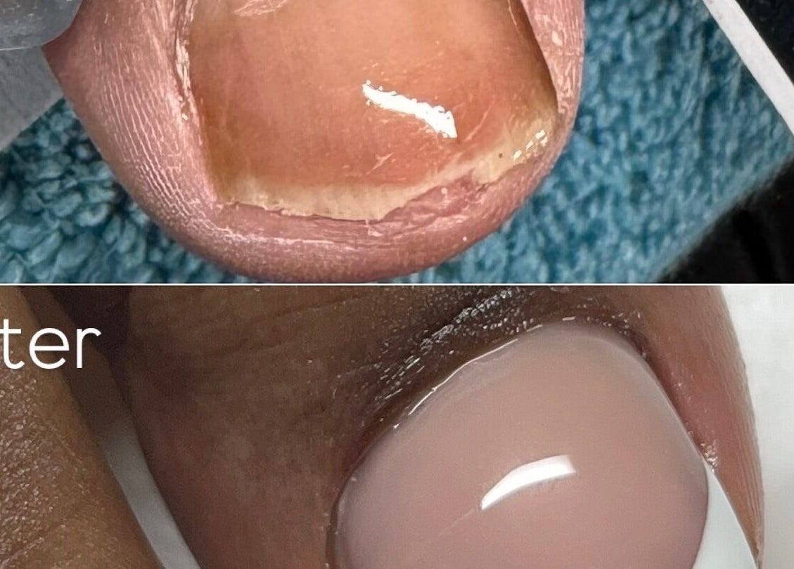 Before and after nail transformation at Mani by Jay, London, England, GB.