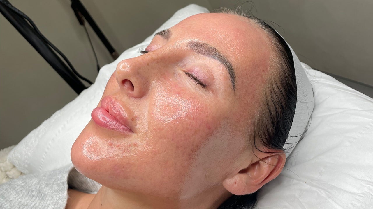 Best chemical skin peel treatments near me in Southampton | Fresha