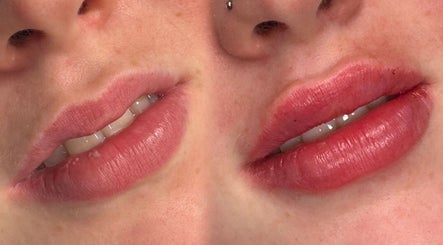 Plump, well-defined lips highlighting a treatment from Soul Sister Aesthetics, Hull, England, GB.