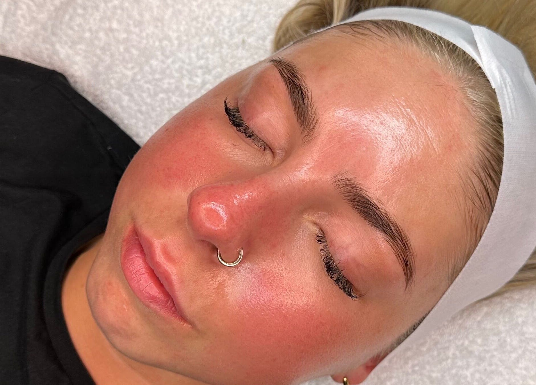 Glowing skin post-treatment at E.L Skin & Brows, Sheffield, England, GB. Experience premium skincare results.