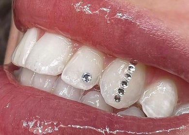 Sparkling tooth gems at Niloofar Beauty in Cannington, Western Australia, AU. Highlight your smile with elegance.