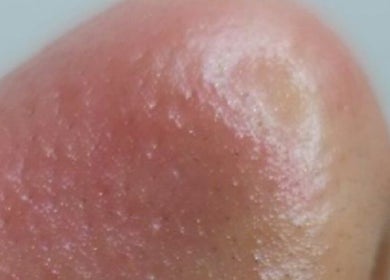 Close-up of healthy skin texture at My Aesthetics Studio (Beauty&Health), Doncaster, England, GB.