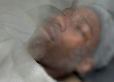 Relaxing facial steam therapy at Radieux Aesthetics, London, England, GB, showcasing serene wellness experience.