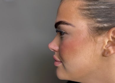 Profile view of woman showcasing beauty at HD Aesthetics Oxford, Kidlington, England, GB.