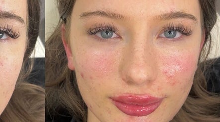 Close-up of facial beauty treatment at Aura Aesthetics Sussex in Worthing, England, GB.