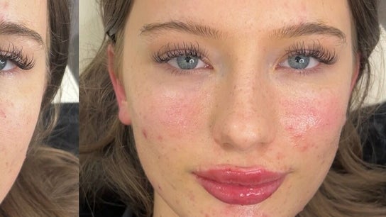 Aura Aesthetics Sussex