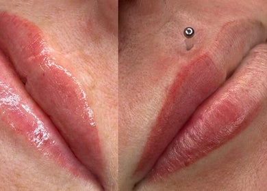 Close-up of beautifully enhanced lips at LeBeauty Studio, Mandurah, Western Australia, AU.