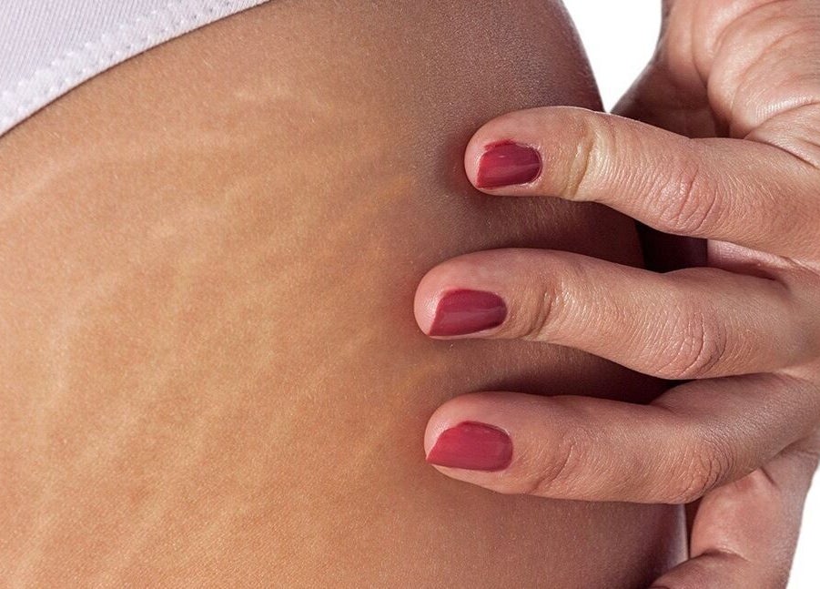 Close-up of hand showing skin texture at Luxe Aesthetics, Ajax, Ontario, CA.