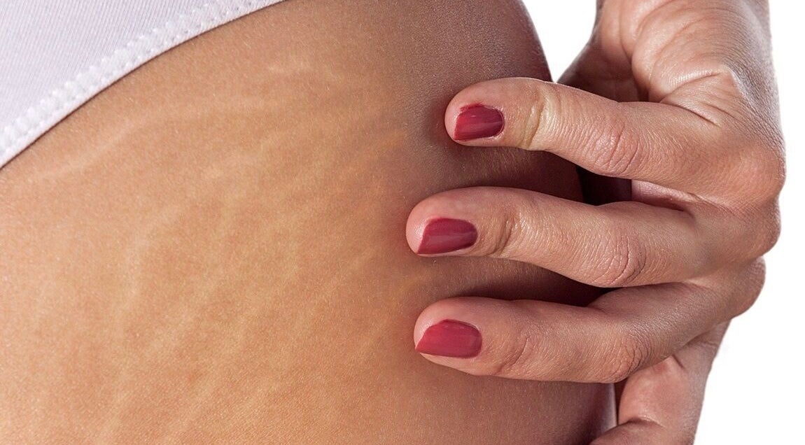 Close-up of hand showing skin texture at Luxe Aesthetics, Ajax, Ontario, CA.