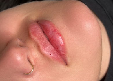 Close-up of enhanced lips at Aesthetic Atelier in Crawley, England, GB showcasing natural beauty.