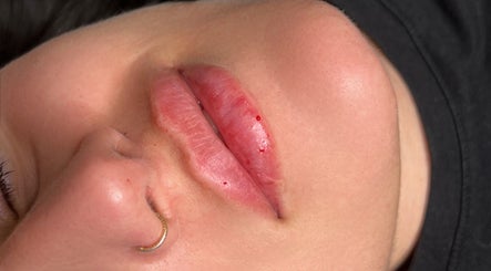 Close-up of enhanced lips at Aesthetic Atelier in Crawley, England, GB showcasing natural beauty.