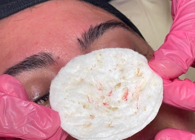 Skincare treatment at Glowberry, Romford, England, GB with pink gloves holding a cotton pad.