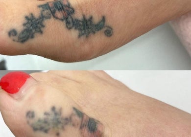 Foot tattoo before and after enhancement at Elevate, Ripon, England, GB.