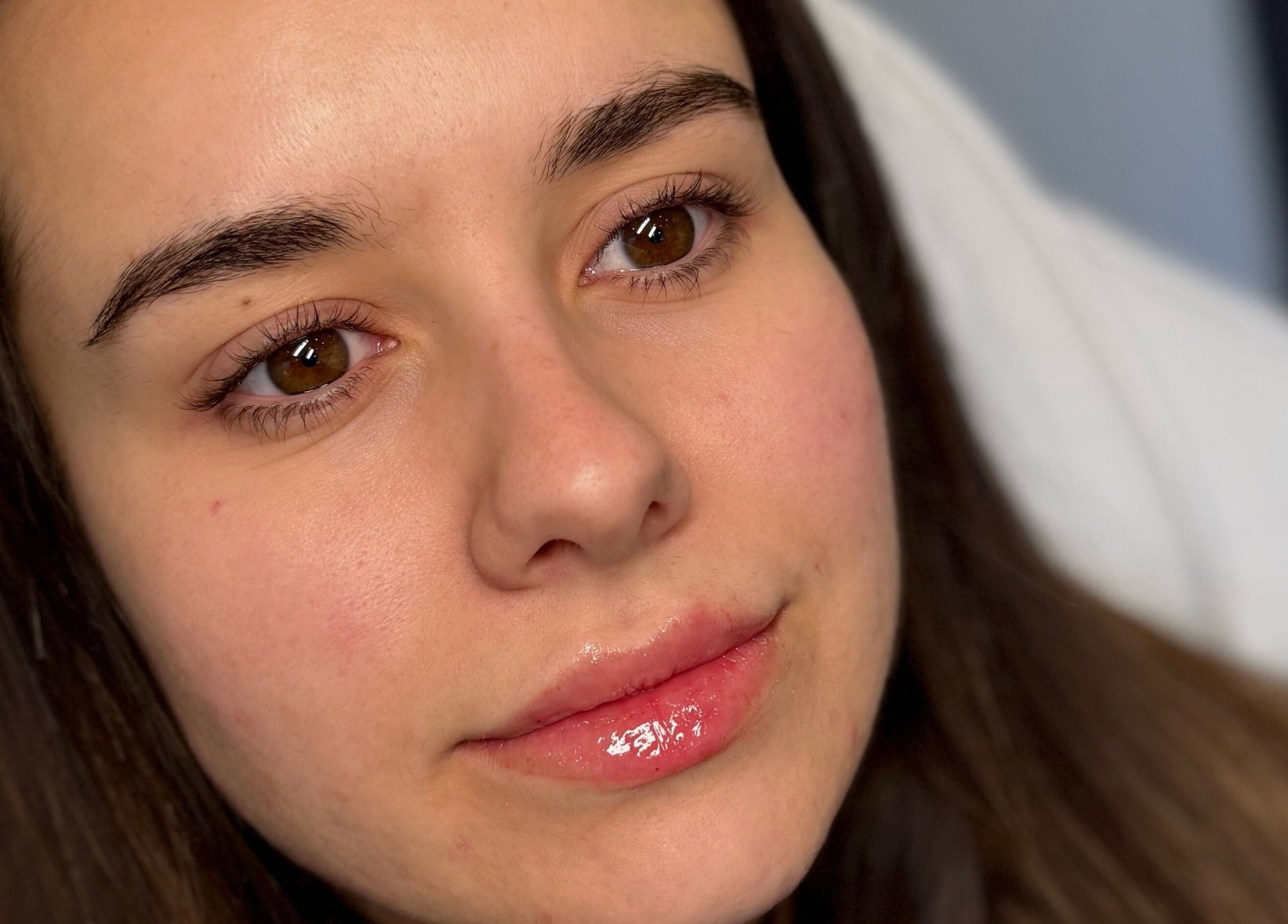 Client's glowing skin after treatment at Sculpt Aesthetics Clinic, Barlaston, England, GB.