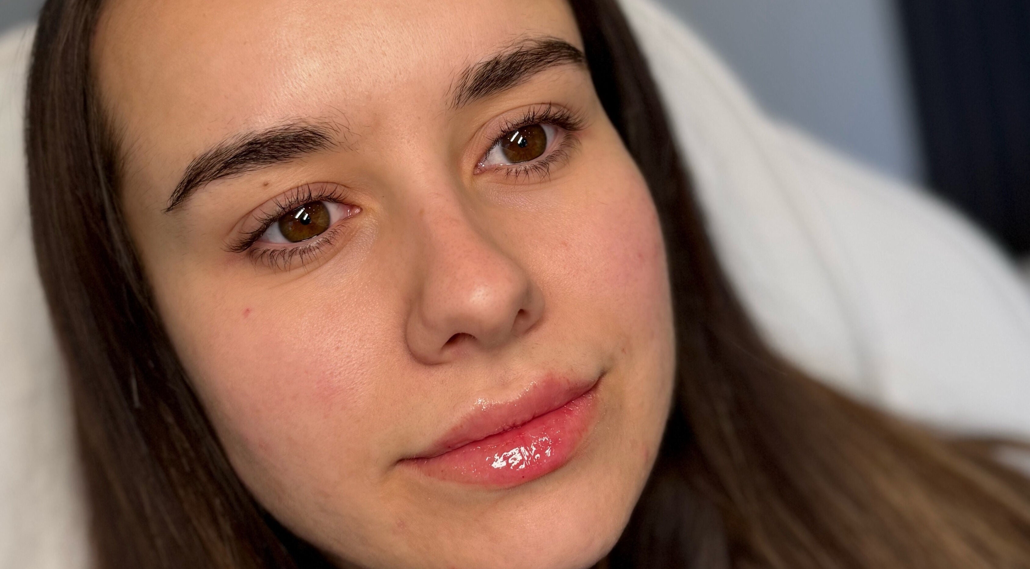 Client's glowing skin after treatment at Sculpt Aesthetics Clinic, Barlaston, England, GB.