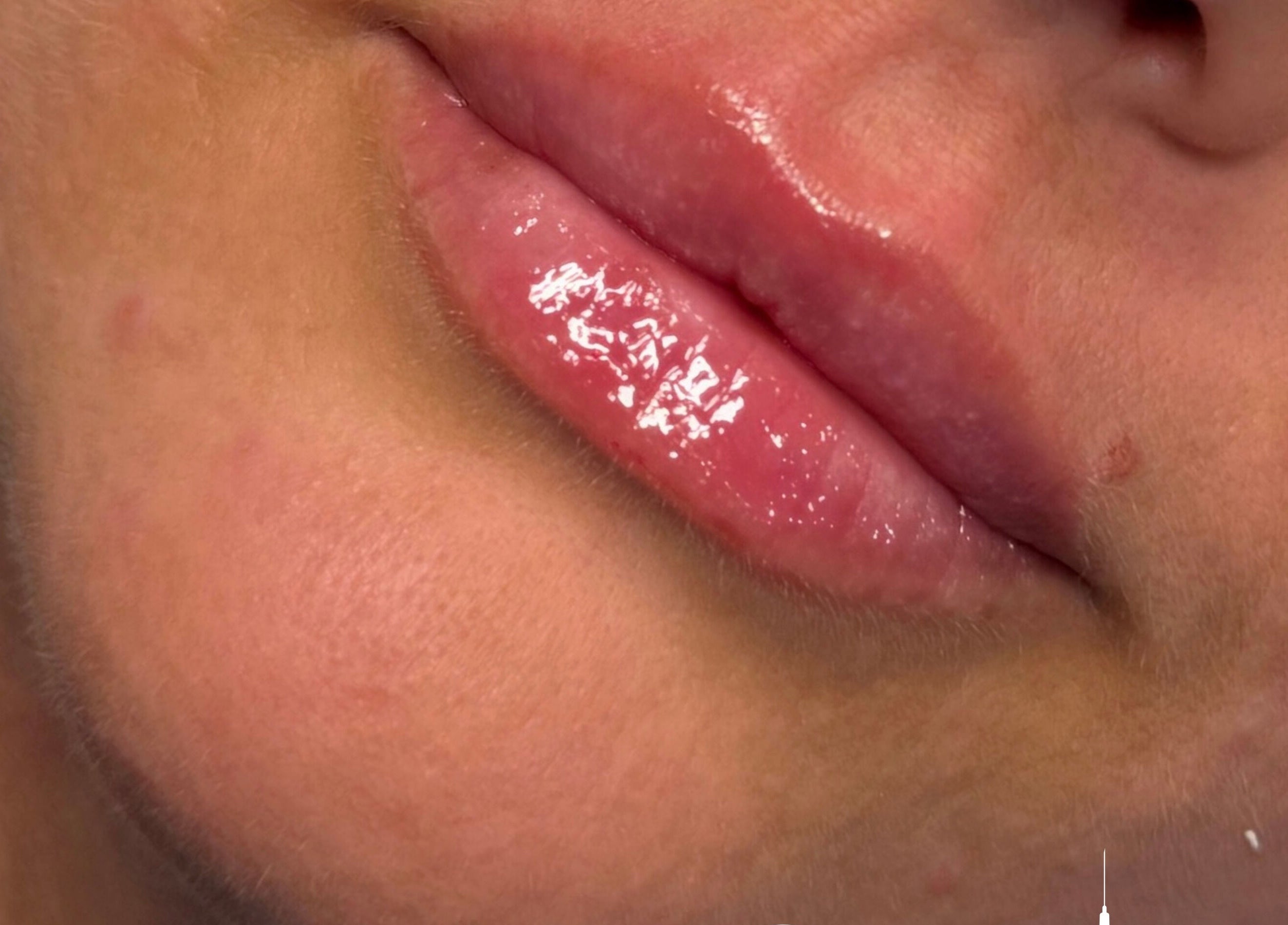 Close-up of glossy lips after treatment at Sculpt Aesthetics Clinic, Barlaston, England, GB.
