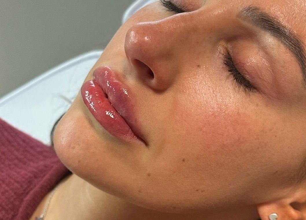 Close-up of a serene woman's face post-treatment at Clinic 01, East Kilbride, Scotland, GB.