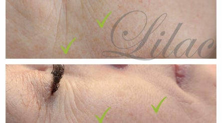 Imagen 2 de Lilac Beauty Skin Brows Lashes