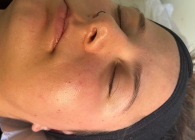 Peaceful face at Beauty and the Belle in Ash Vale, England, GB, showcasing smooth, glowing skin after a facial.