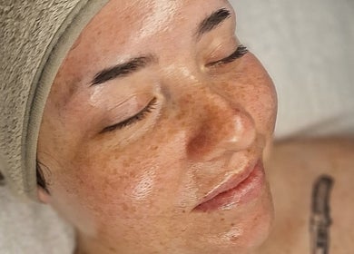 Relaxing facial treatment at Amethyst Aesthetics Exmouth, Exmouth, England, GB. Experience rejuvenation and wellness.
