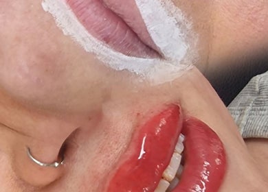 Close-up of a lip treatment in progress at Amethyst Aesthetics Exmouth, Exmouth, England, GB.