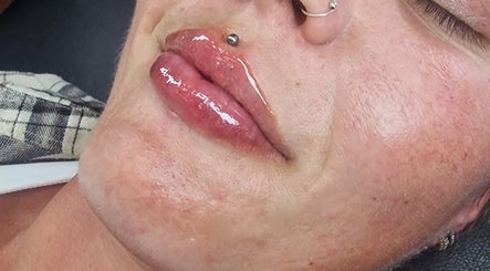 Glossy lips showcasing lip treatment at Amethyst Aesthetics Exmouth, Exmouth, England, GB.