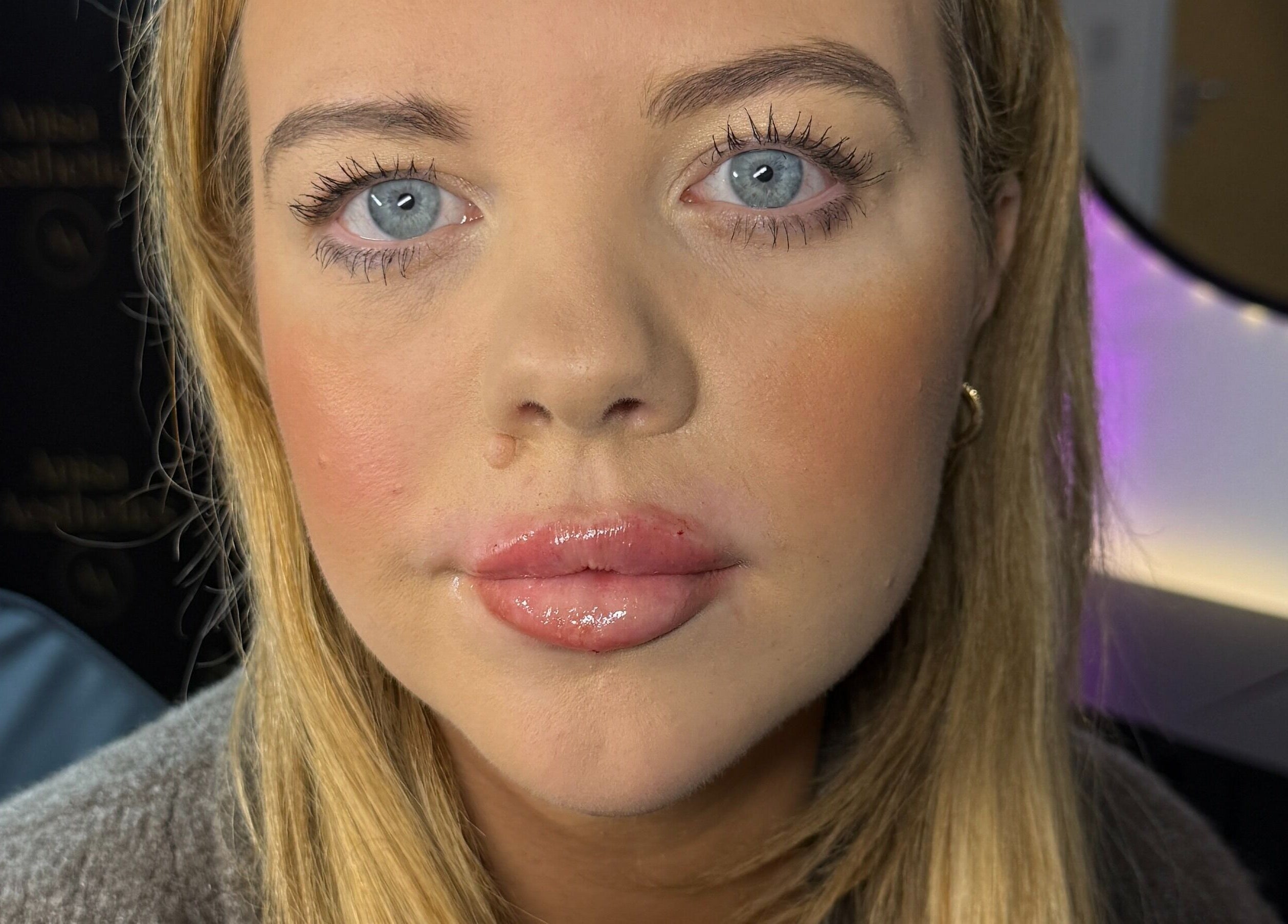 Close-up of a client with radiant skin at Anisa Aesthetics, Peterborough, England, GB.