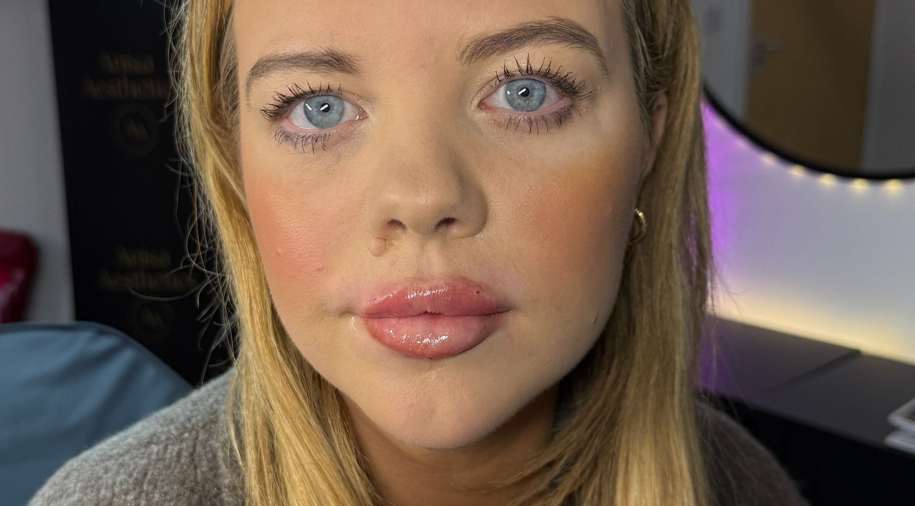 Close-up of a client with radiant skin at Anisa Aesthetics, Peterborough, England, GB.