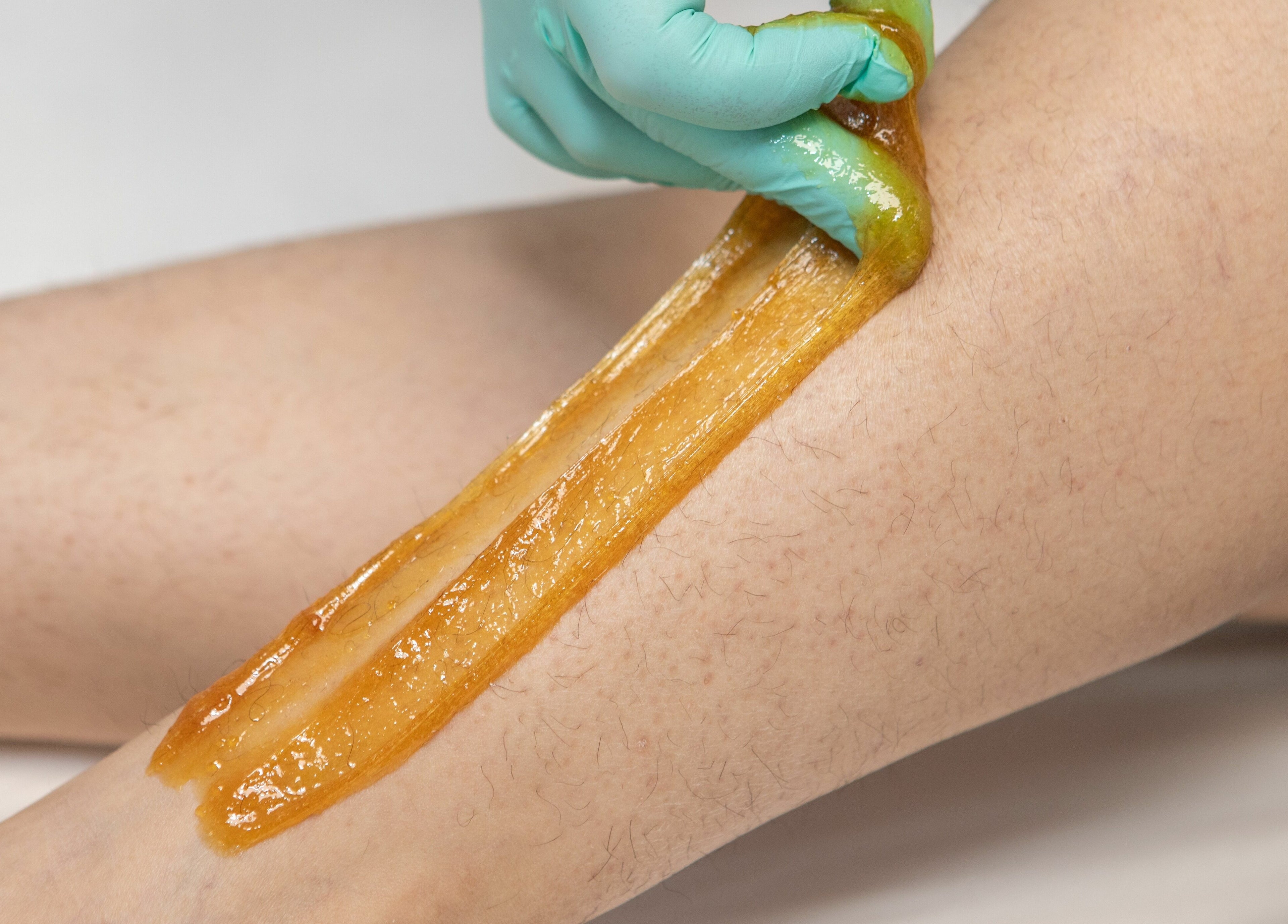 Sugaring hair removal in process at Lovely Sugaring, Toronto, Ontario, CA for smooth, silky skin.