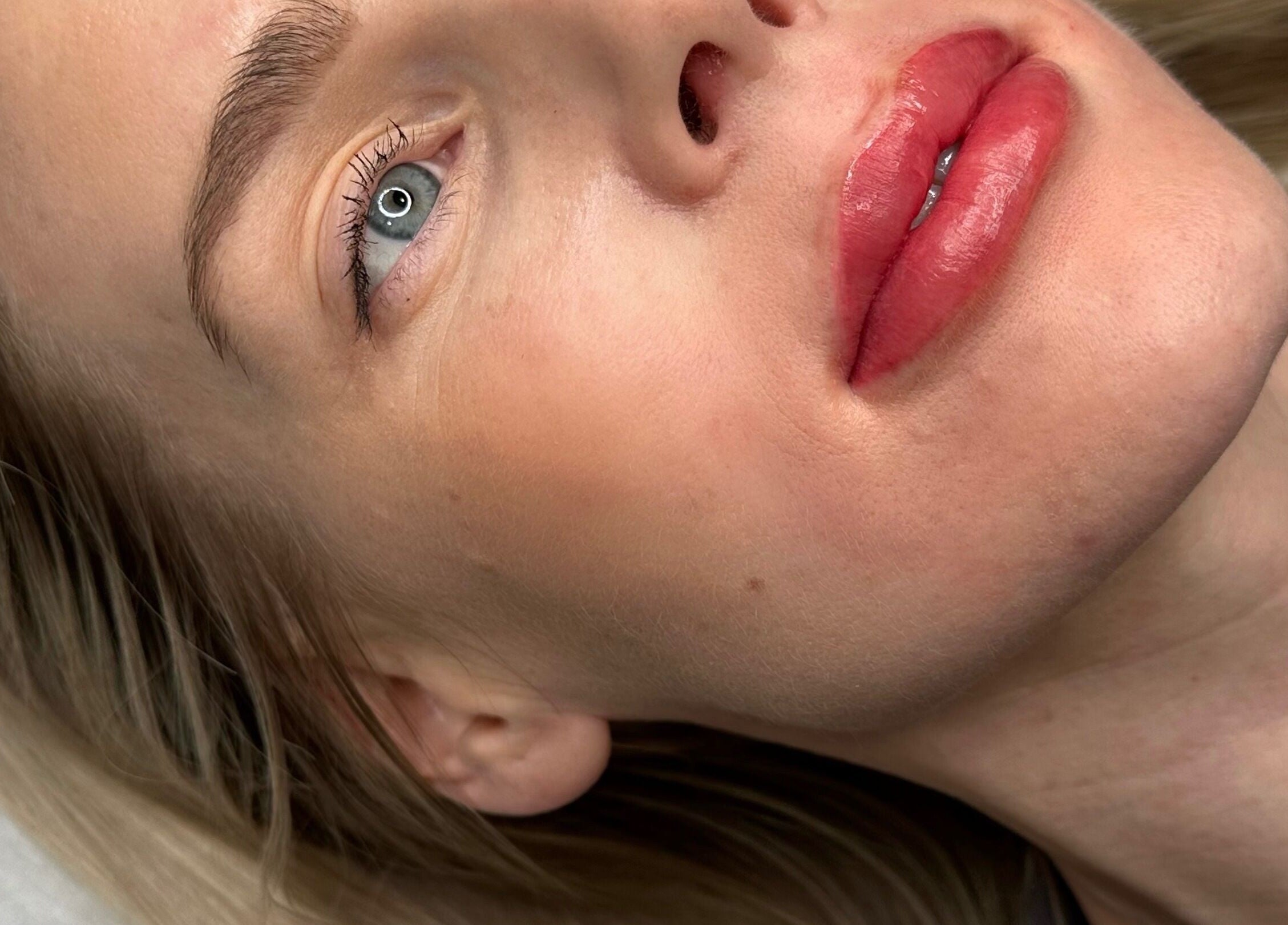 Close-up of a woman's face showcasing skin rejuvenation at AURA THE CLINIC, Newcastle upon Tyne, England, GB.