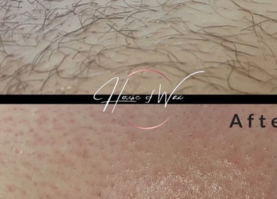 Before and after leg waxing at House of Wax, Wrexham, Wales, GB, showcasing hair removal results.