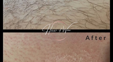 Before and after leg waxing at House of Wax, Wrexham, Wales, GB, showcasing hair removal results.
