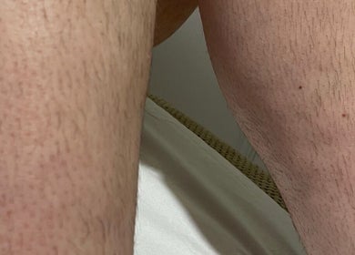 Close-up of legs before waxing at House of Wax, Wrexham, Wales, GB, showcasing natural growth.