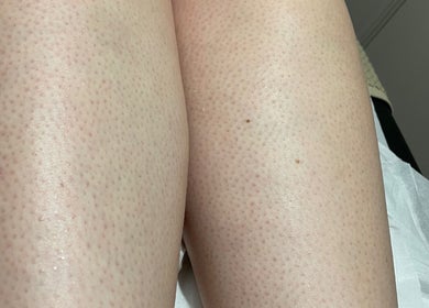 Smooth skin care treatment results at House of Wax, Wrexham, Wales, GB.