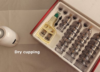 Cupping therapy kit at LGholistic complementary and physical therapies clinic, Limerick, County Limerick, IE.