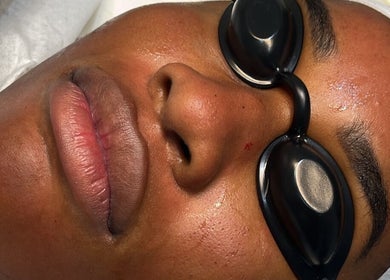 Client relaxing during a facial at Rm Lashes, London, England, GB, highlighting skin rejuvenation treatment.