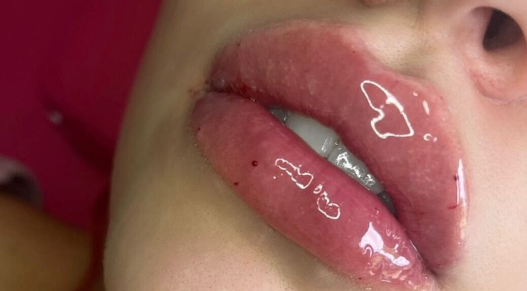 Close-up of glossy lips at Dream House Aesthetics, Newcastle upon Tyne, England, GB.