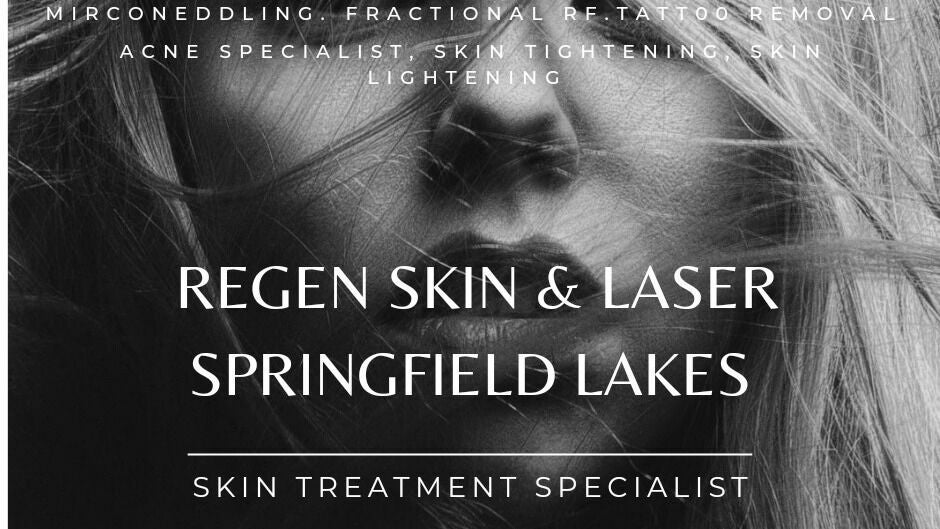 Skin Casa 13/2 lakes entrance drive, springfield lakes 4300