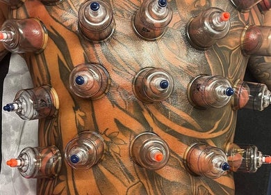Cupping session on tattooed back at Atelier, Stockton-on-tees, England, GB. Enhancing wellness naturally.