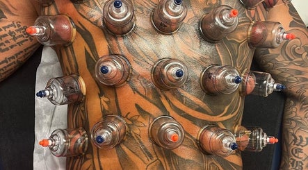 Cupping session on tattooed back at Atelier, Stockton-on-tees, England, GB. Enhancing wellness naturally.