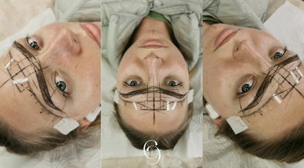 Clinically Contoured image 3