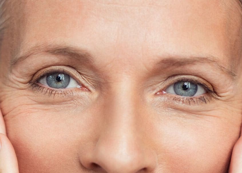 Close-up of rejuvenated eyes at Radiant Skin Aesthetics, Umhlanga, KwaZulu-Natal, ZA.