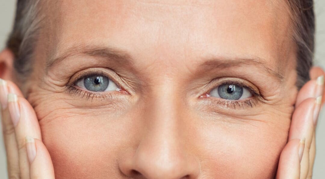 Close-up of rejuvenated eyes at Radiant Skin Aesthetics, Umhlanga, KwaZulu-Natal, ZA.