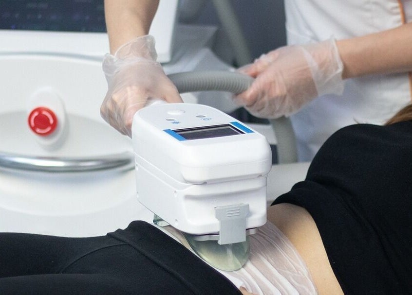 CoolSculpting treatment at BellaDonna Aesthetics & Wellness DT Calgary, located in Calgary, Alberta, CA.
